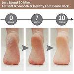 Flawless Pedi Electronic Tool File and Callus Remover