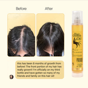 Hair Growth Oil