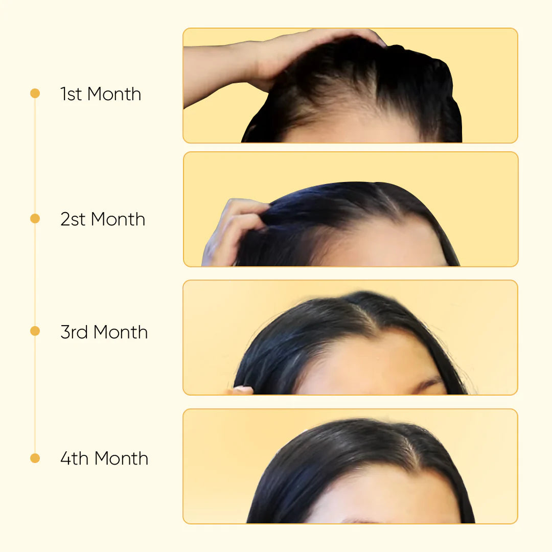 Hair Growth Oil