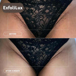 Imported™ Painless Reusable Razor For Girls & Women 🎁